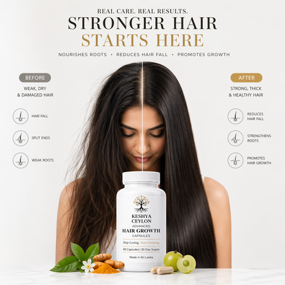 Keshya Ceylon™  Hair Growth Capsules